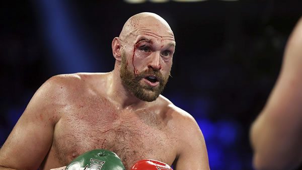 tyson-fury-boxer Tyson Fury